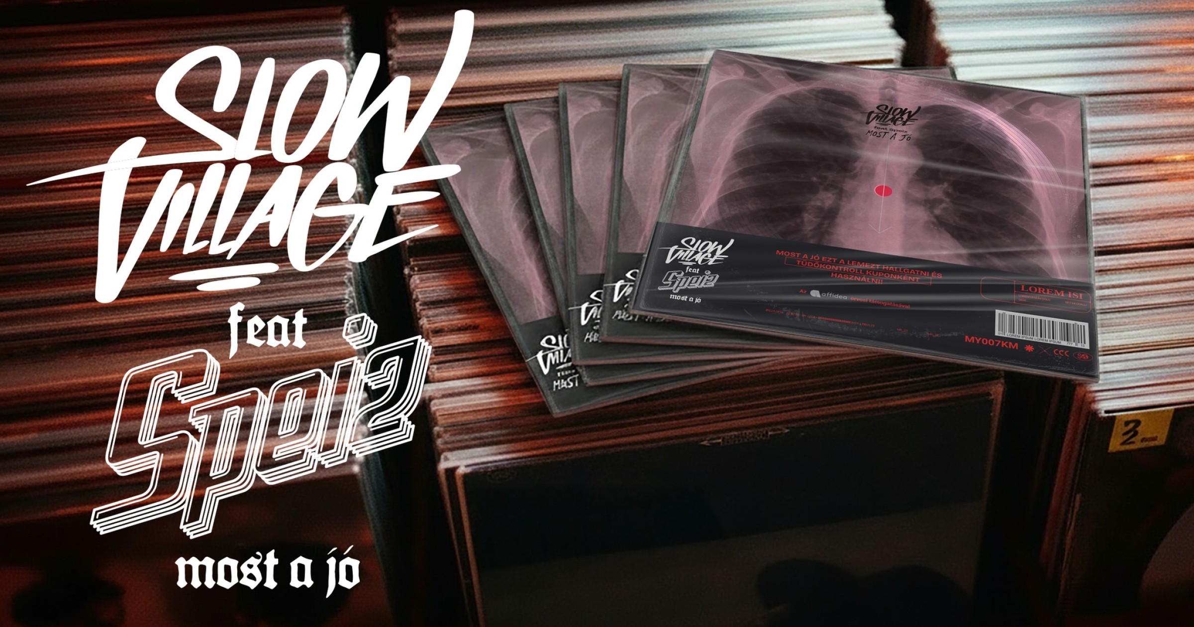 Slow Village - Röntgenlemez az idei RSD kiadványok között